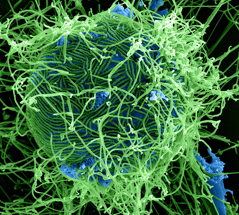 Ebola Virus Particles