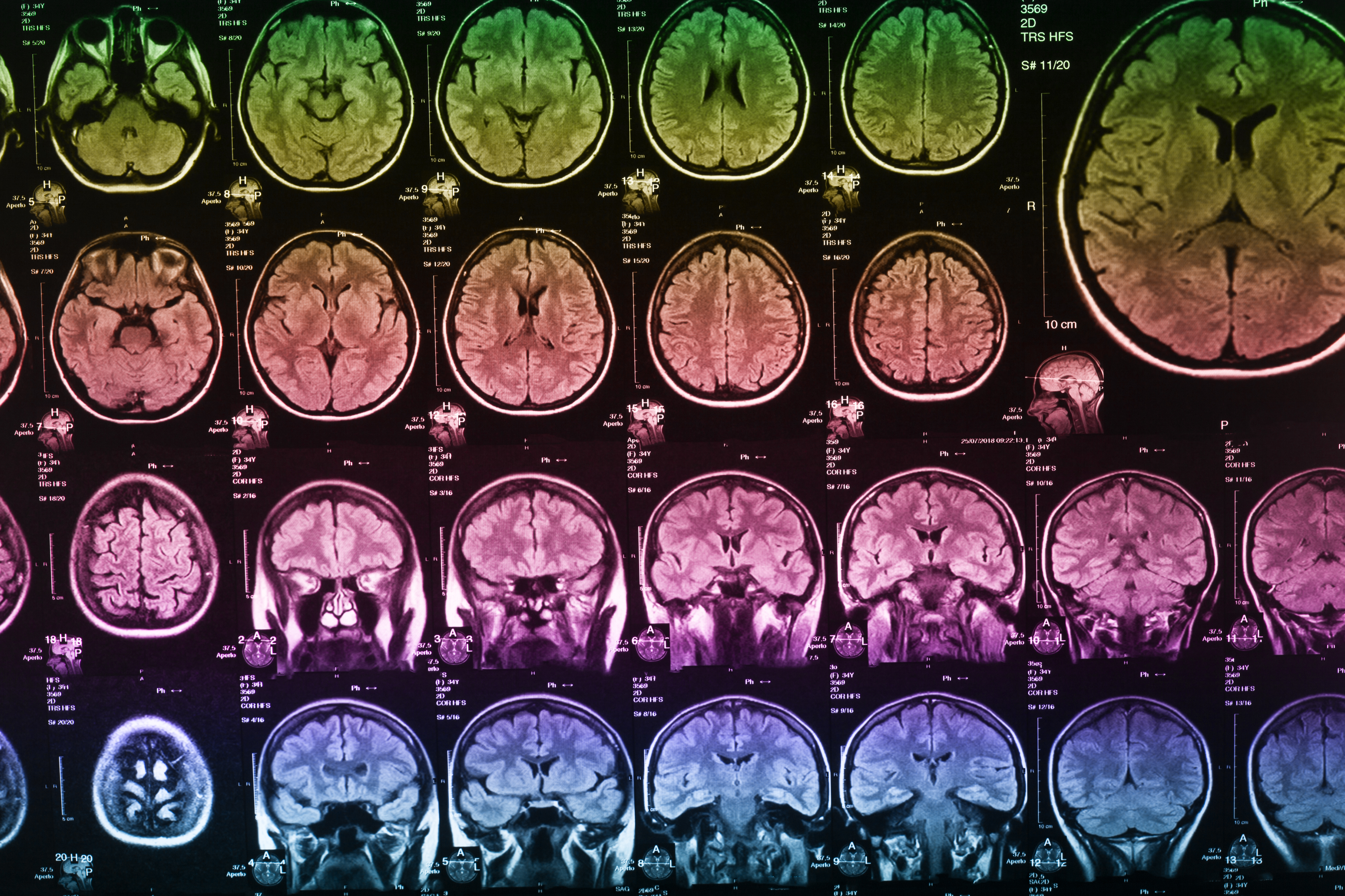 The X-ray of the human brain