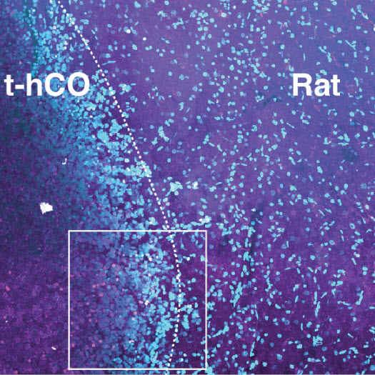 Image showing transplanted human cortical organoids made from cells taken from individuals with Timothy syndrome with immunostaining. 