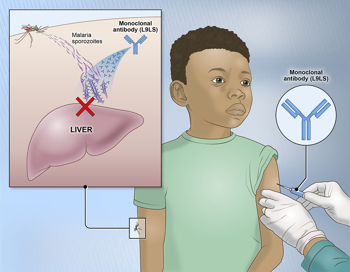 Illustration that shows how the monoclonal antibody neutralizes the malaria parasite.