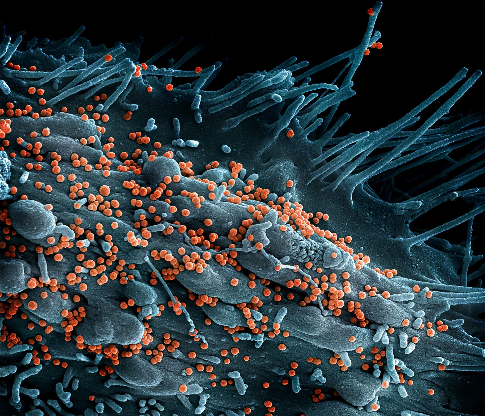 Scanning electron micrograph of Lassa virus budding off a cell. Scanning electron micrograph of Lassa virus budding off a cell.