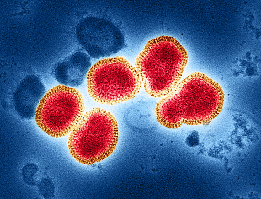Influenza A Virus (H3N2) Influenza A Virus (H3N2)