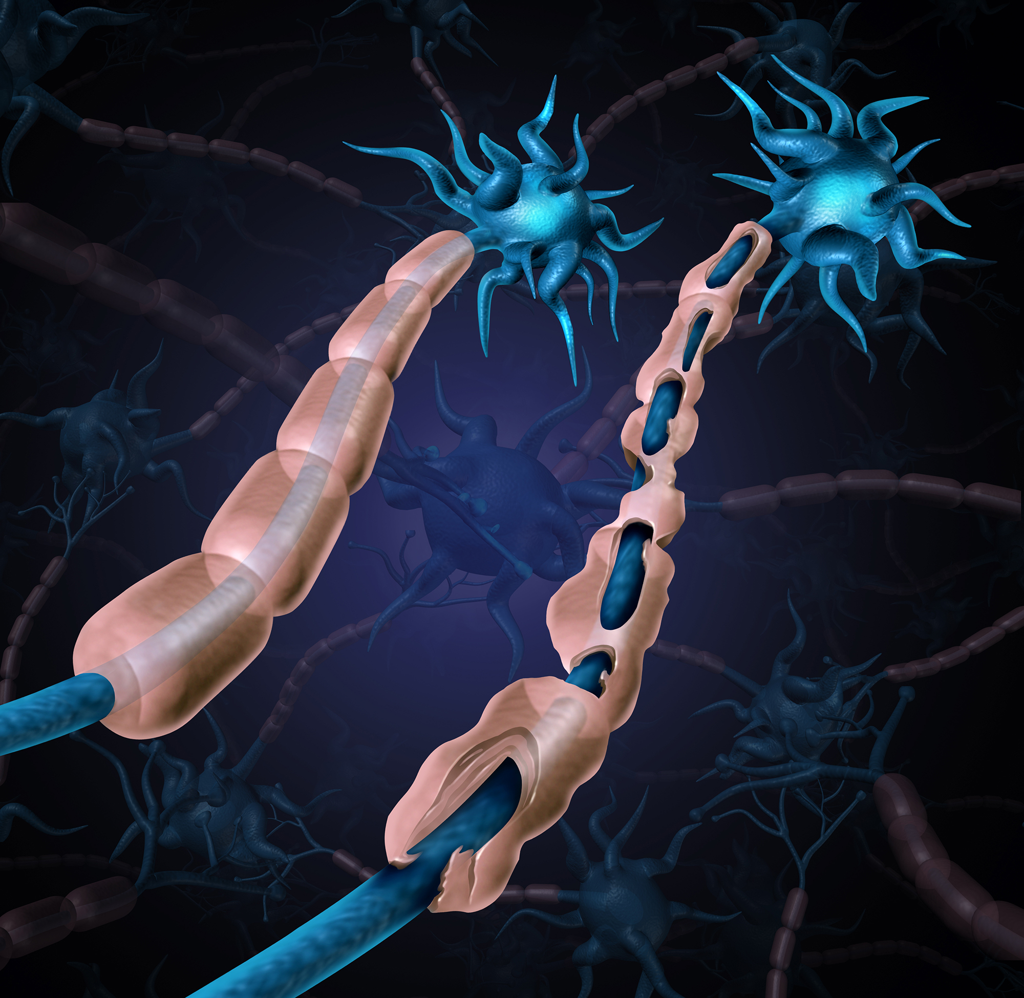 3d illustration of a degrading neuron