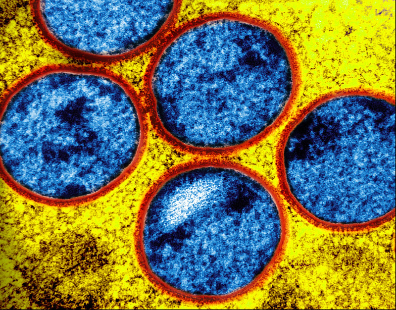 Microscopic image of immature mpox virus spheres. Microscopic image of immature mpox virus spheres.