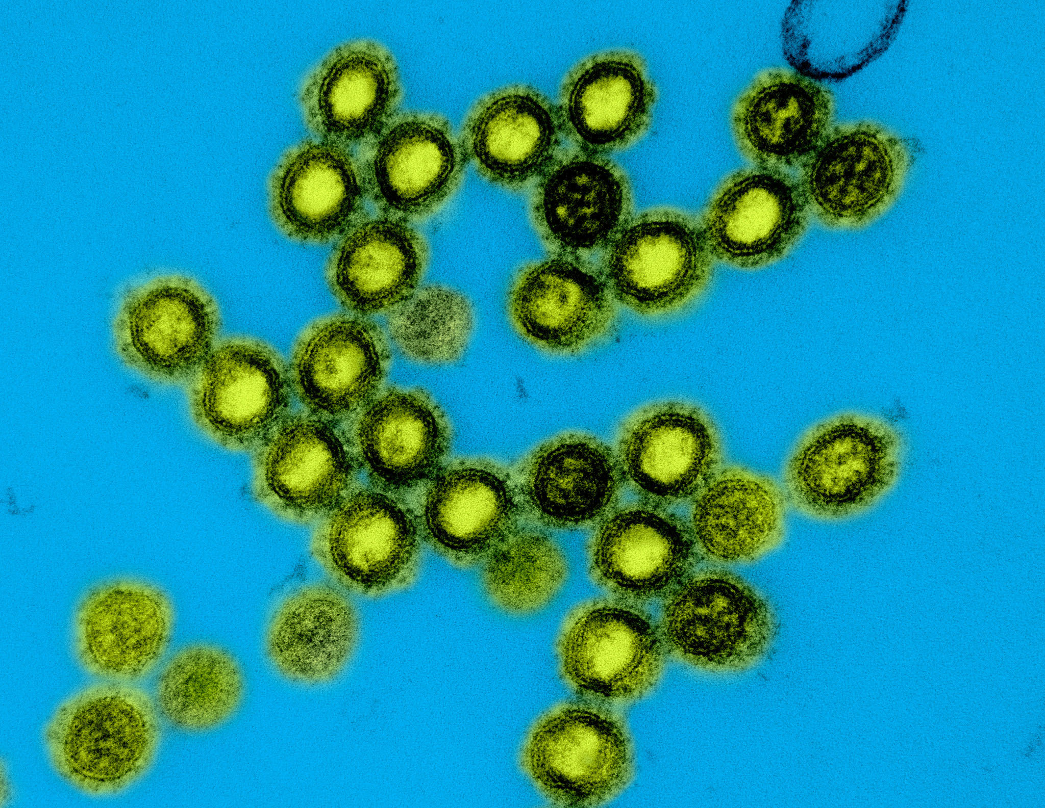 Colorized transmission electron micrograph of influenza A/H1N1 virus particles. Colorized transmission electron micrograph of influenza A/H1N1 virus particles.