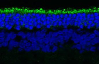 shorter rod photoreceptors next to longer rods treated with reserpine. shorter rod photoreceptors next to longer rods treated with reserpine.