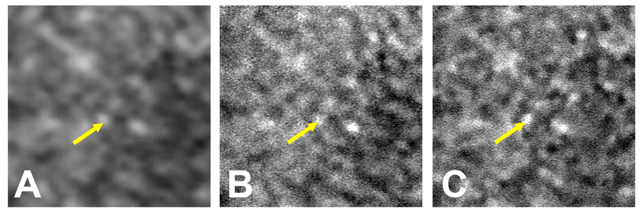 3 slides of retina tissue taken using three separate imaging techniques. Each image gets progressively clearer. 3 slides of retina tissue taken using three separate imaging techniques. Each image gets progressively clearer.