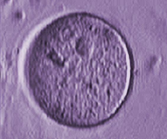 Oocyte.