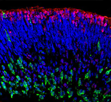 Induced pluripotent stem cells form a structure with layers of cells.