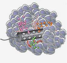 Illustration of cylindrical device inside a tumor.