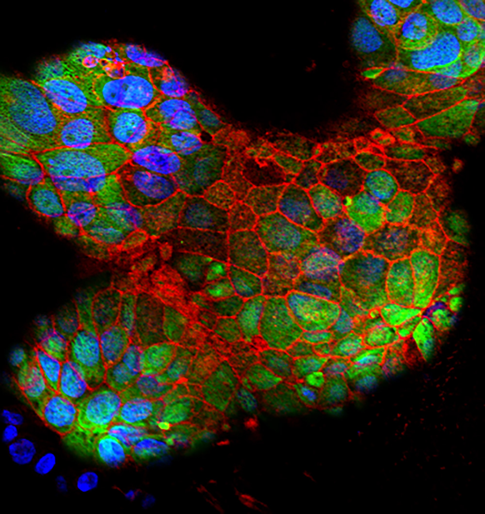 Placental cells grown in bioreactor