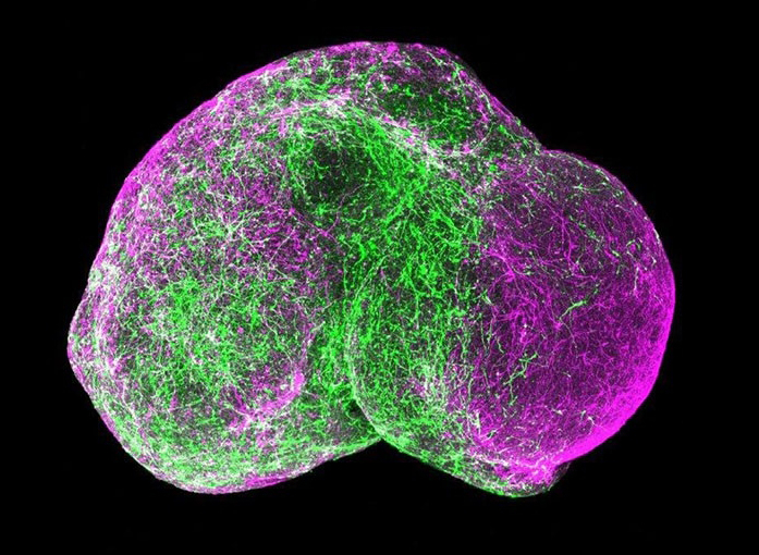 Fused forebrain spheroids