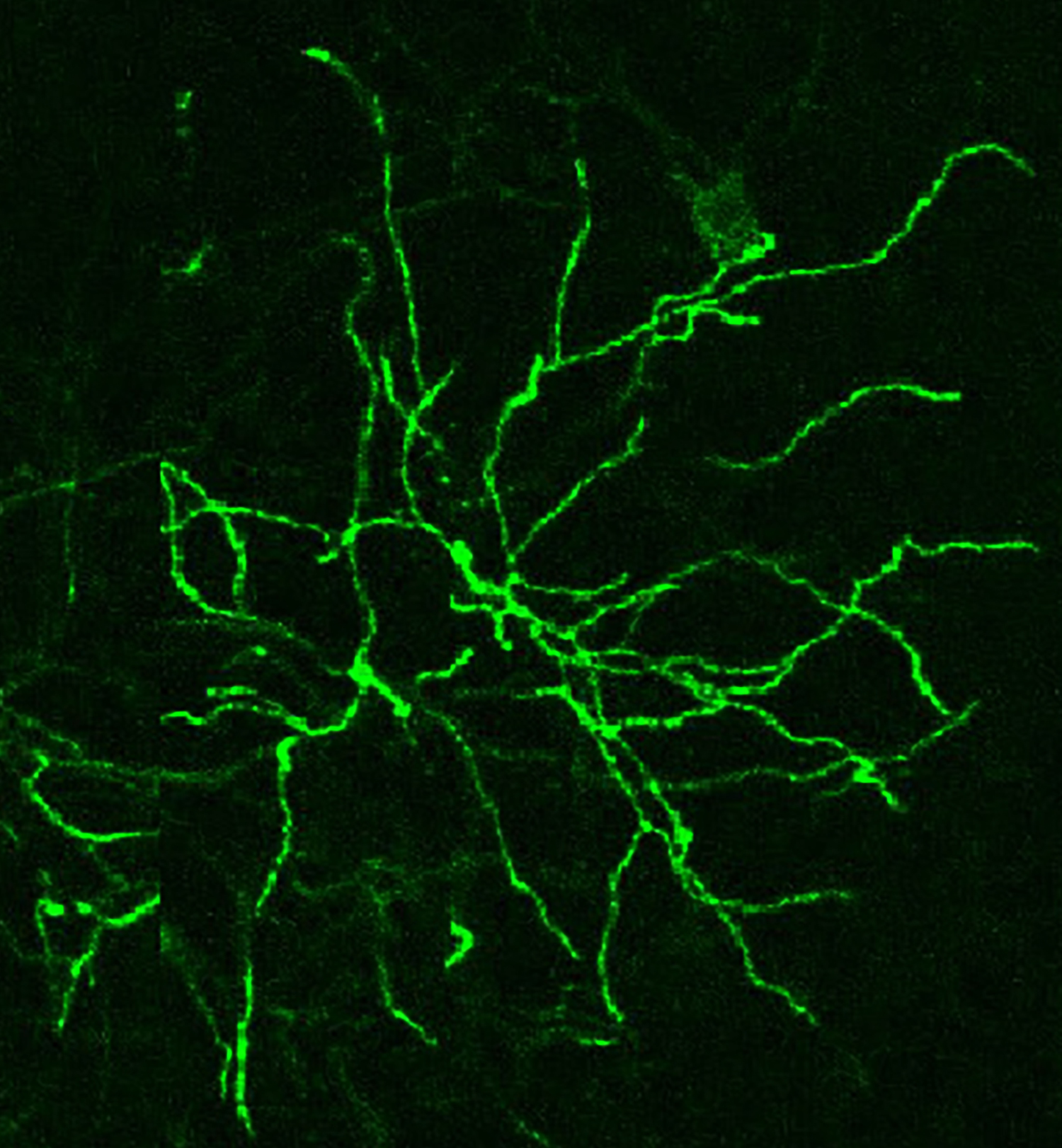 Gfp. Нейробиология употребление.