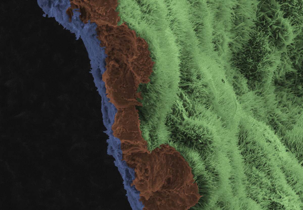 Polarized RPE monolayer on biodegradable scaffold.