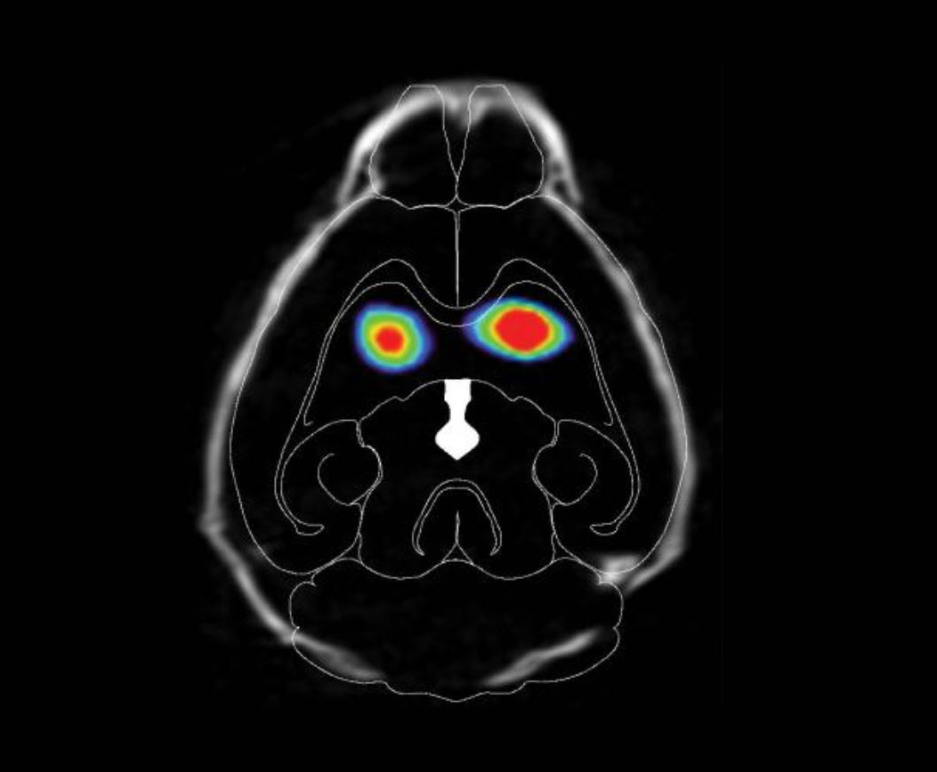 Tracking the spread of Parkinson’s proteins from gut to brain ...