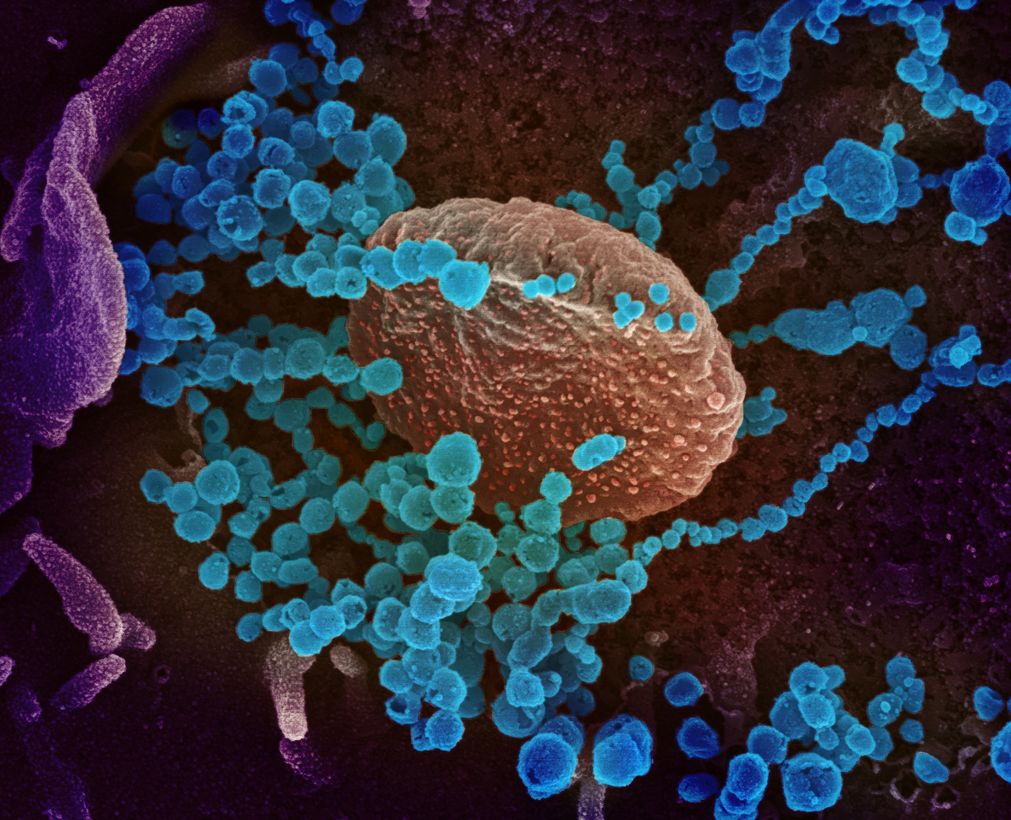 SARS-CoV-2 virus particles