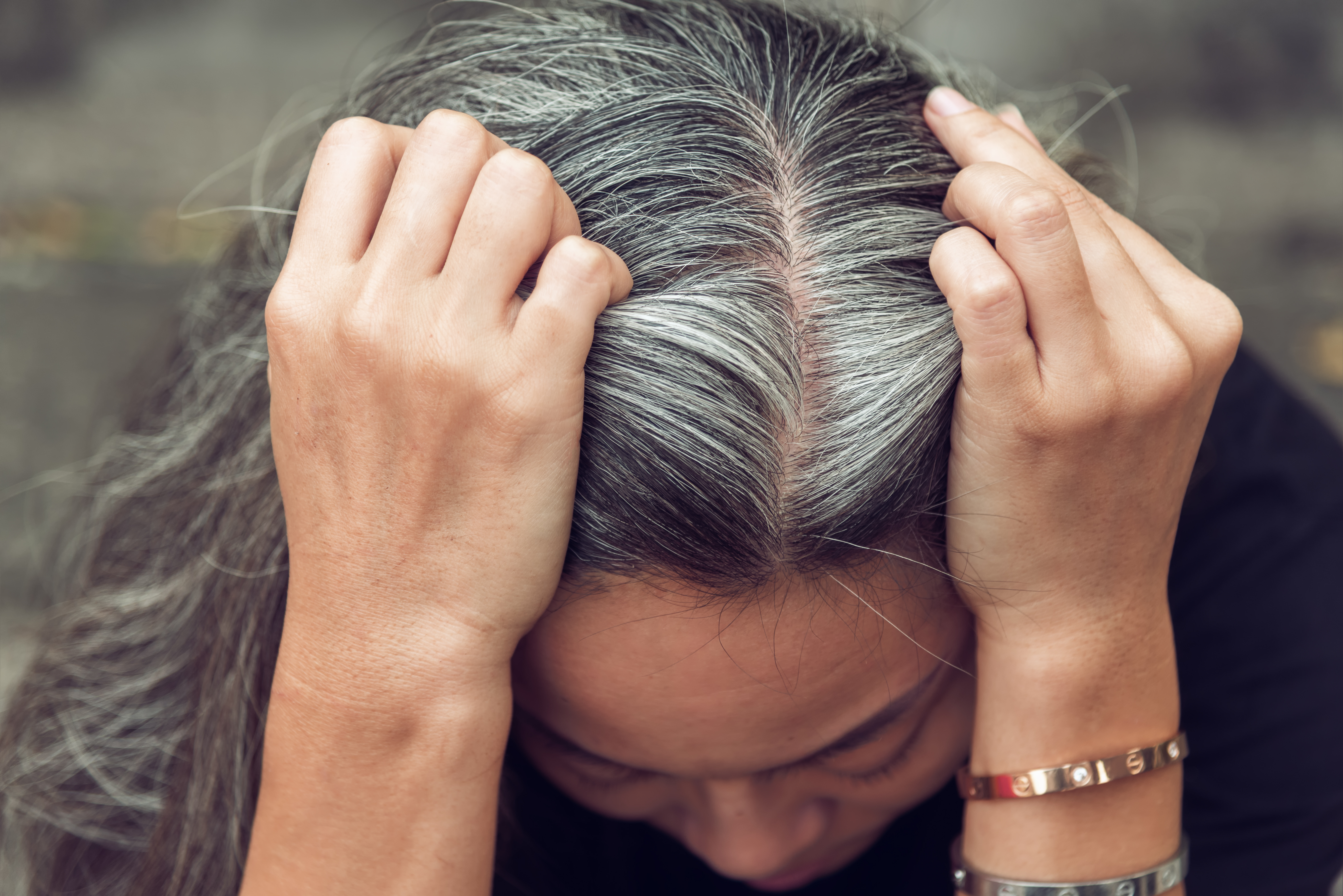 Aging melanocyte stem cells and gray hair