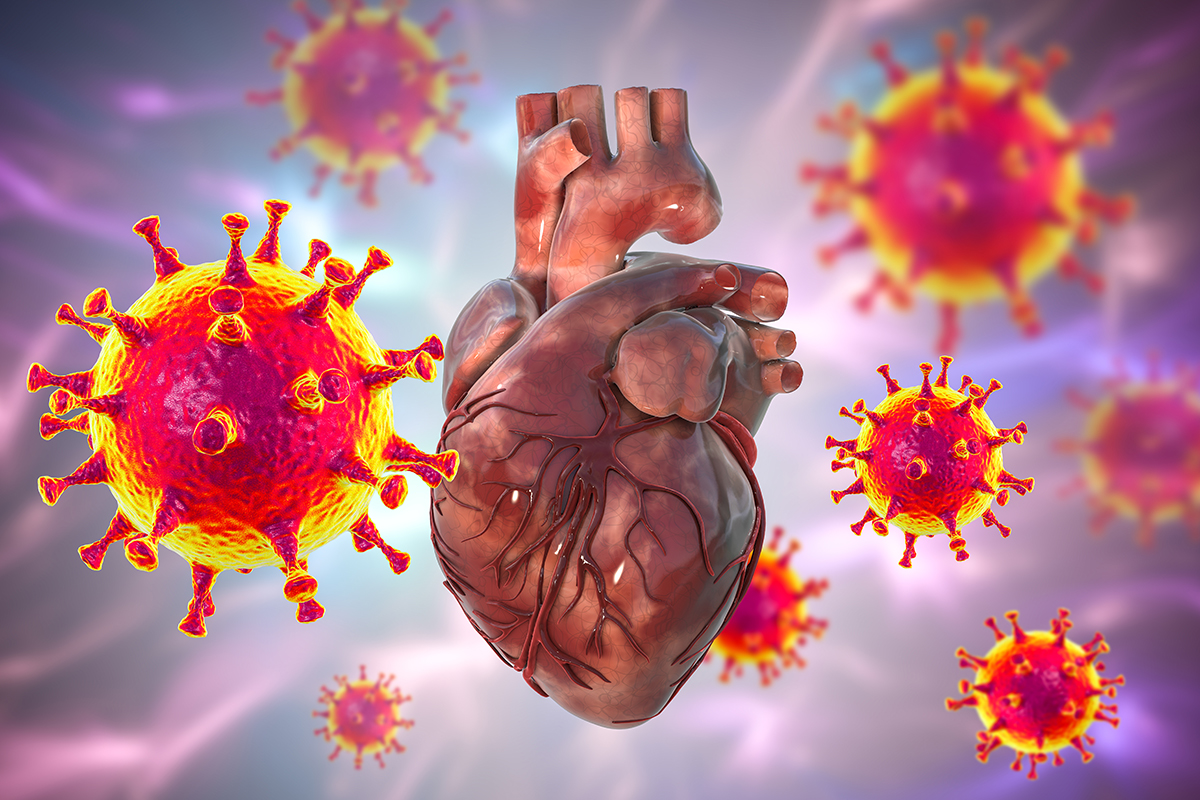 Illustration of a human heart surrounded by enlarged SARS-CoV-2 viruses.