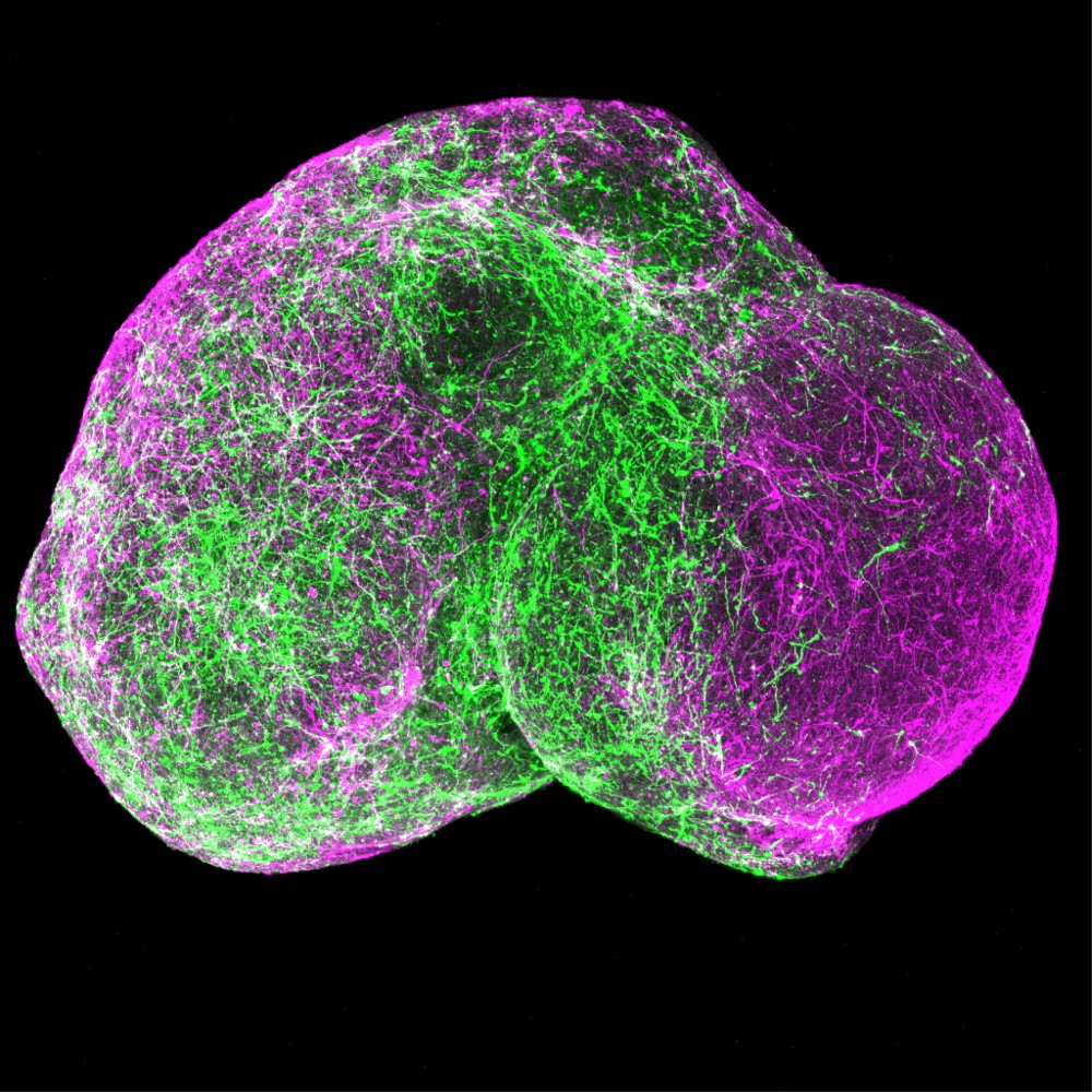 Image of a spherical organoid.