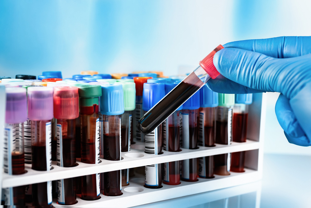 Gloved hand holding a test tube with a blood sample. Gloved hand holding a test tube with a blood sample.