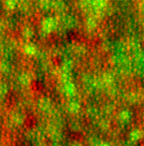 Photoreceptor cells (red) and supportive retinal pigment epithelial cells (green), imaged in a living human eye using adaptive optics Microscopic image of a retina.
