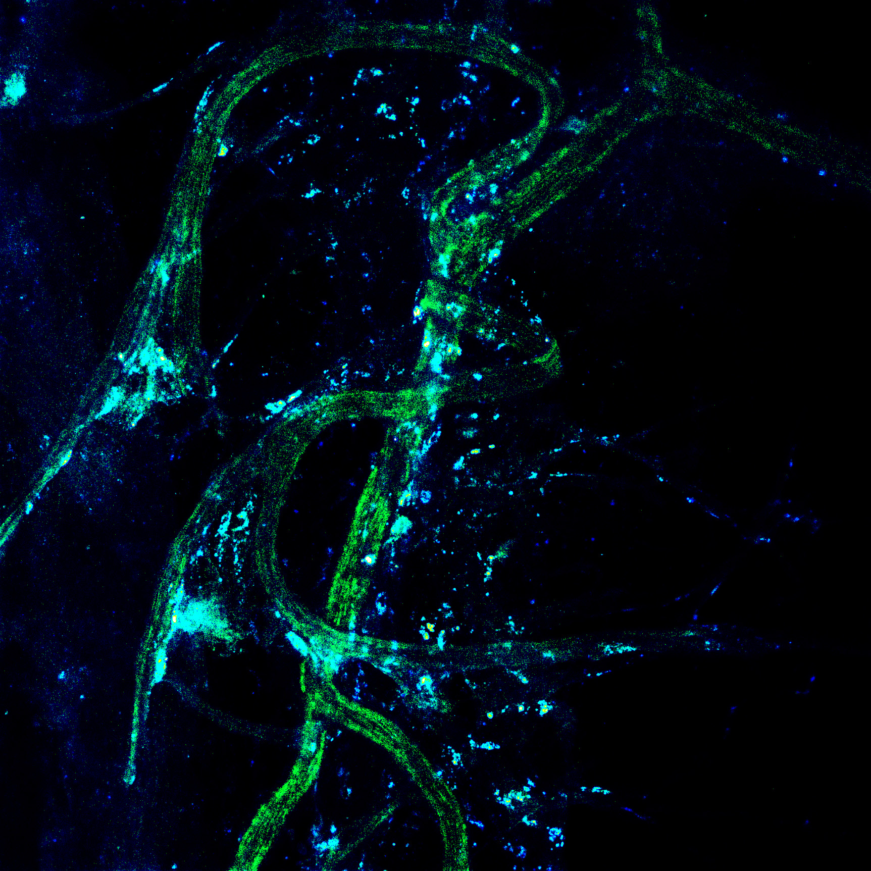 Confocal microscopy image shows Treg cells clustered next to long nerve cells. Confocal microscopy image shows Treg cells clustered next to long nerve cells.