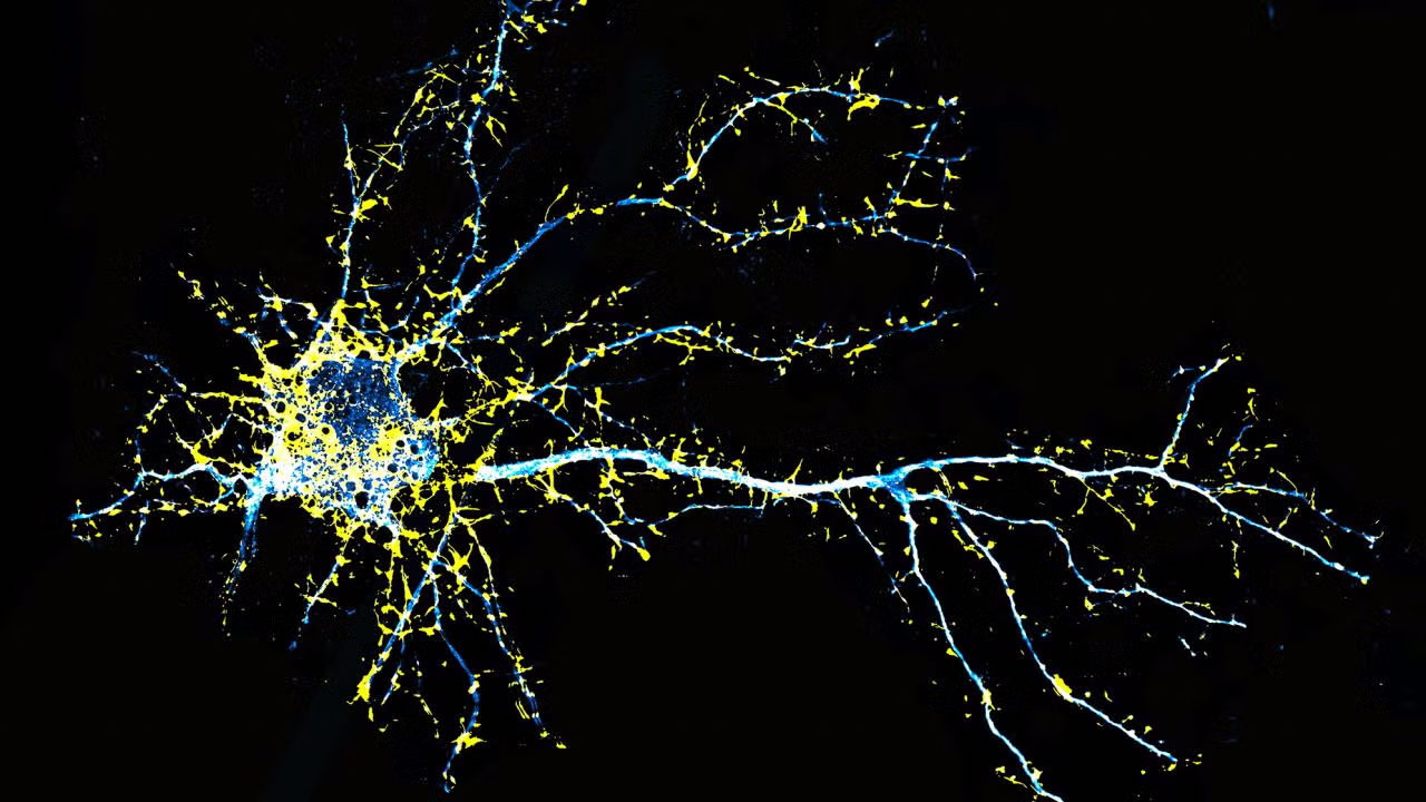 Fluorescence microscopy image of a cortical neuron. Fluorescence microscopy image of a cortical neuron.