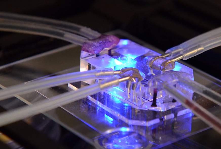 Lung-on-a-chip. Lung-on-a-chip.