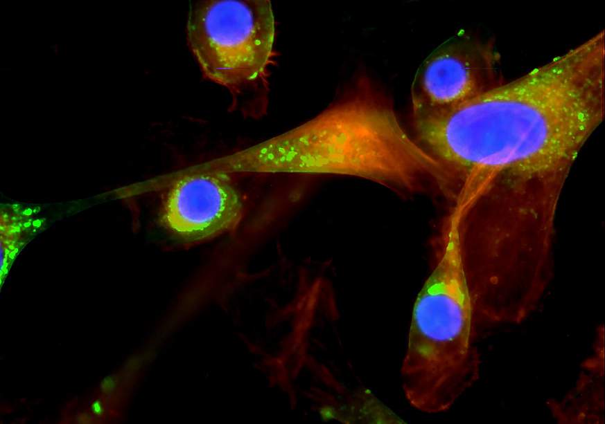 Oral pathogen invasion of human gum cells Oral pathogen invasion of human gum cells