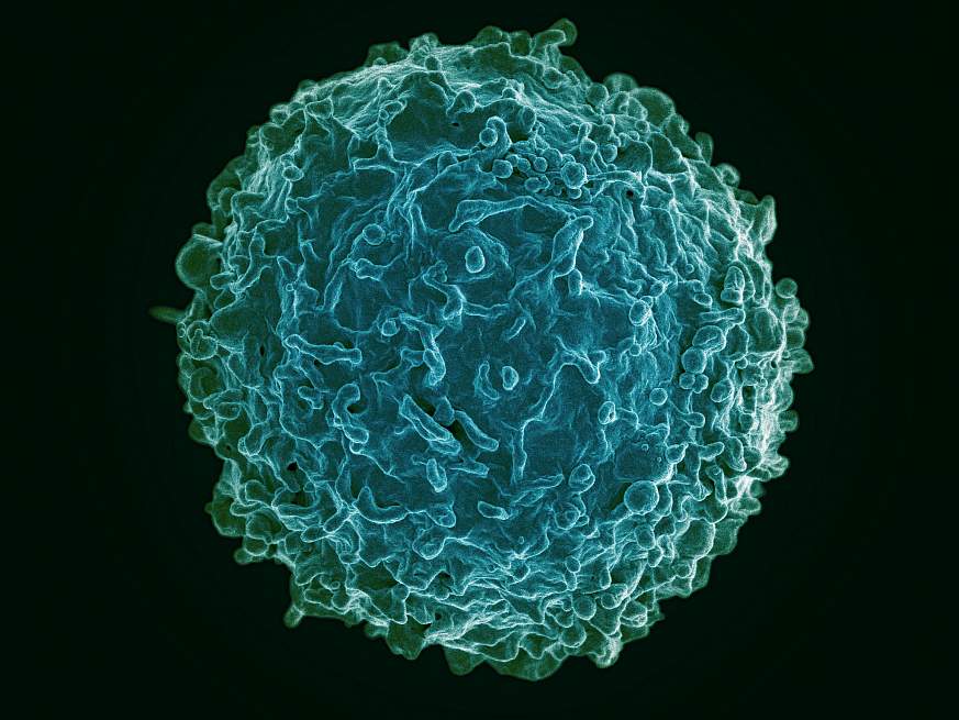 Human B Lymphocyte Human B Lymphocyte