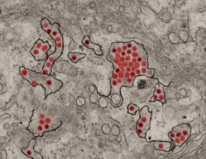Microscopic image of Zika virus particles Microscopic image of Zika virus particles
