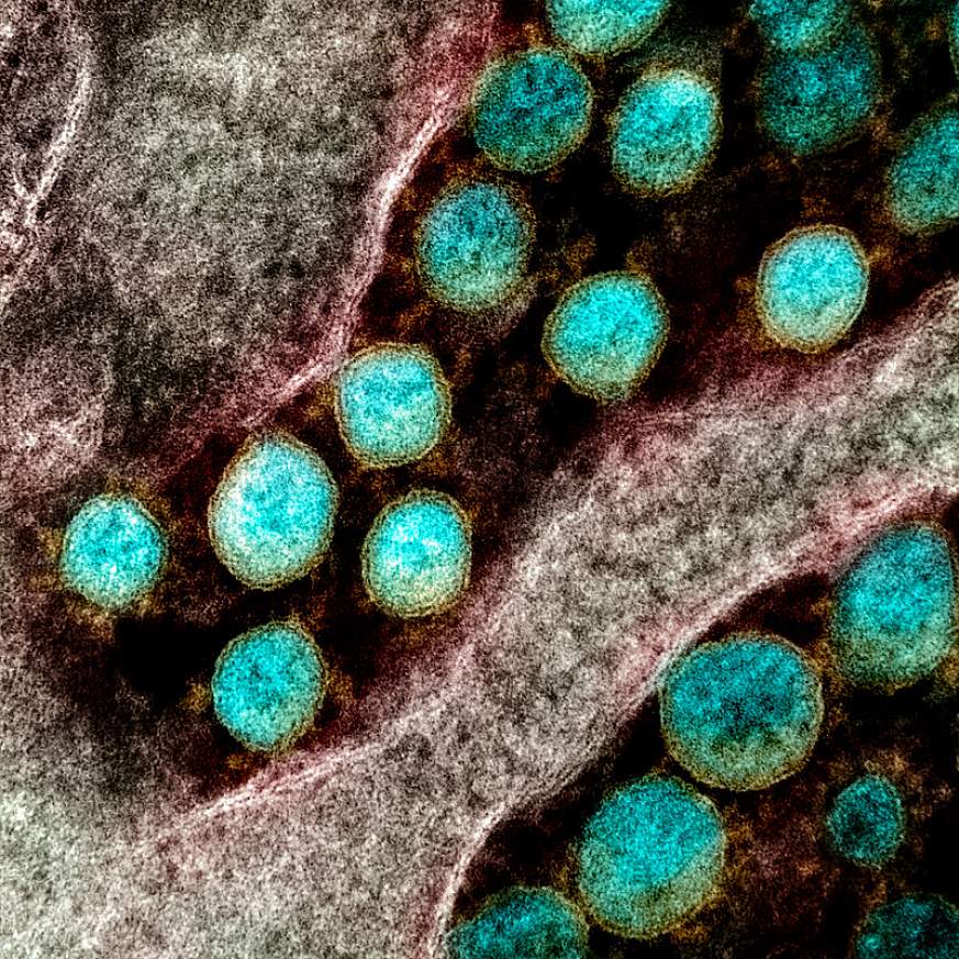 Novel Coronavirus SARS-CoV-2 Novel Coronavirus SARS-CoV-2