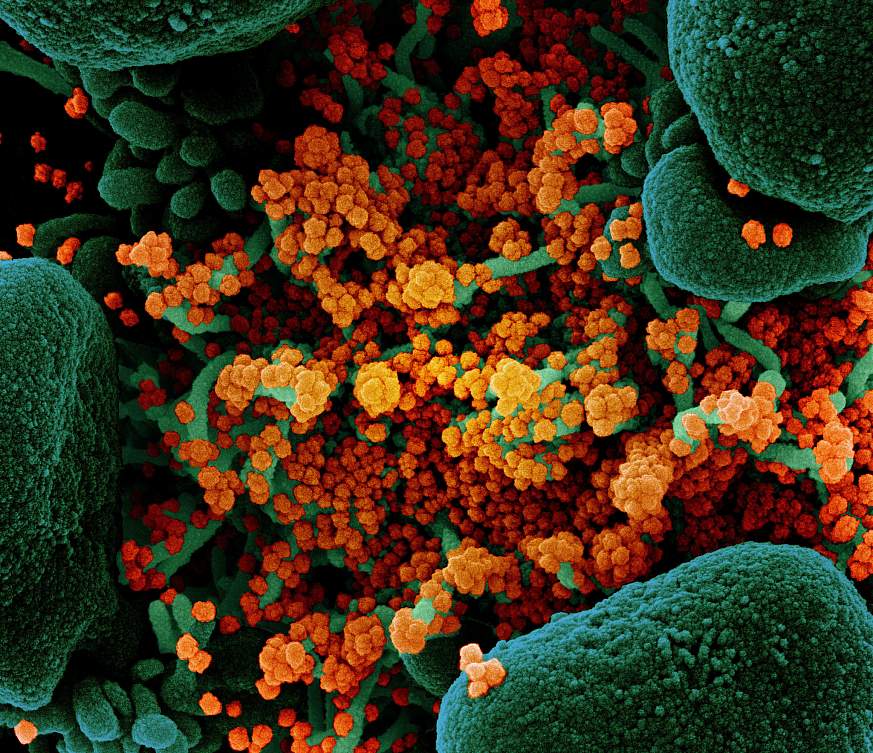 Novel Coronavirus SARS-CoV-2 Novel Coronavirus SARS-CoV-2