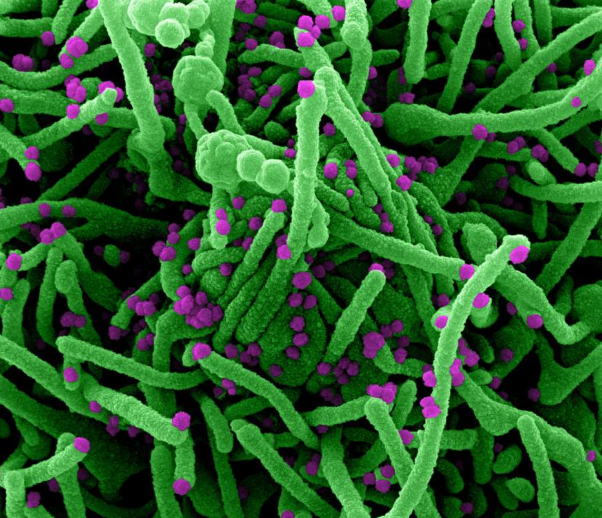 Novel Coronavirus SARS-CoV-2 Novel Coronavirus SARS-CoV-2