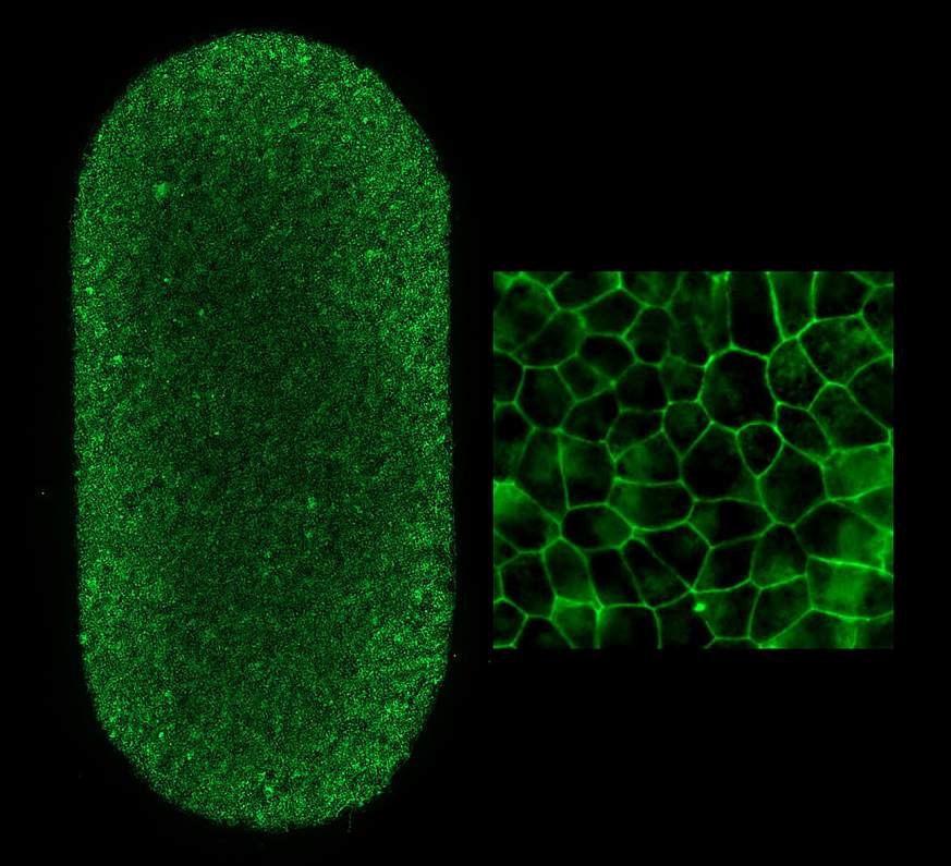 Image of RPE patch Image of RPE patch