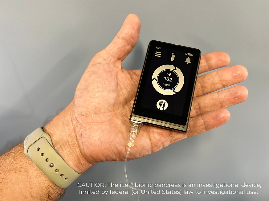 Hand holding the iLet bionic pancreas device Hand holding the iLet bionic pancreas device