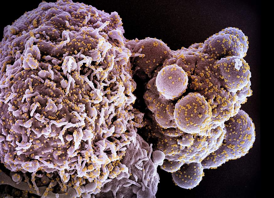 Novel Coronavirus SARS-CoV-2 (Omicron Novel Coronavirus SARS-CoV-2 (Omicron