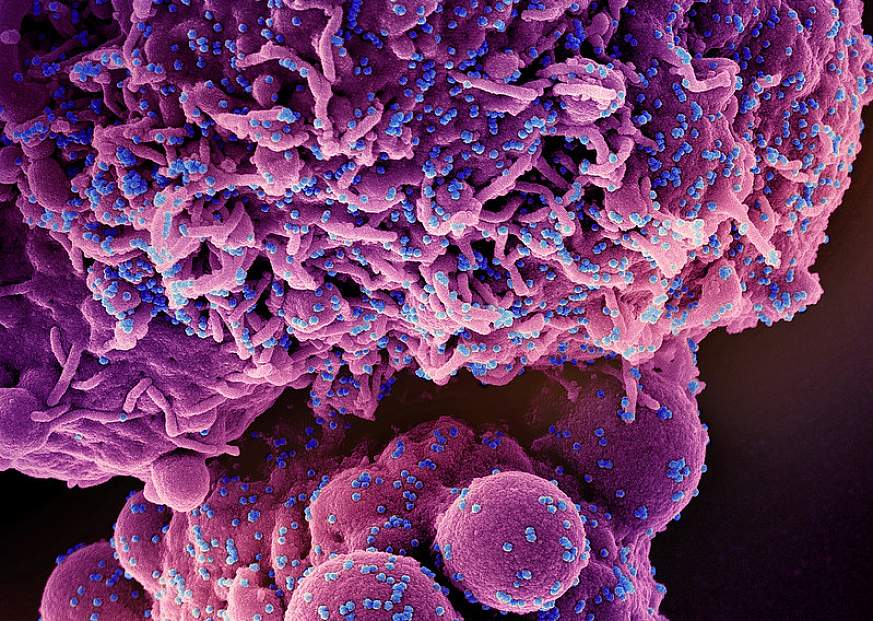 Novel Coronavirus SARS-CoV-2 (Omicron) Novel Coronavirus SARS-CoV-2 (Omicron)