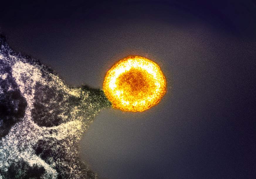 HIV-1 Virus Particle HIV-1 Virus Particle