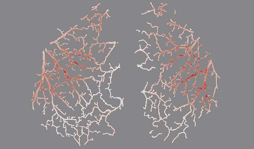 Illustration of blood vessels in the mouse brain