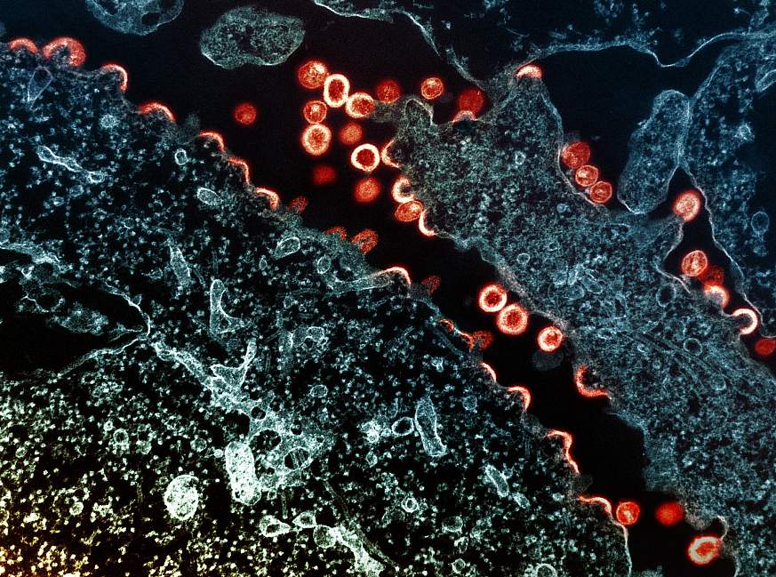 HIV Virus