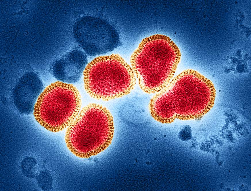 Influenza A Virus (H3N2) Influenza A Virus (H3N2)