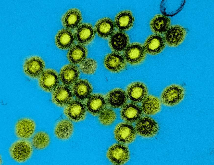 Colorized transmission electron micrograph of influenza A/H1N1 virus particles. Colorized transmission electron micrograph of influenza A/H1N1 virus particles.
