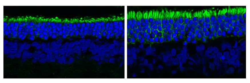 Side-by-side images show untreated, shorter rod photoreceptors next to longer rods treated with reserpine. Side-by-side images show untreated, shorter rod photoreceptors next to longer rods treated with reserpine.