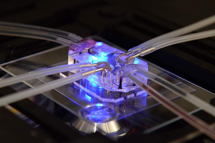 Lung on a Chip Lung on a Chip