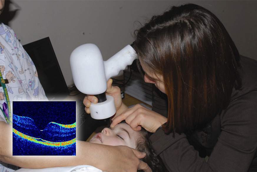 Hand-held scanning of a child's eye, with image of healthy retina (inset) Hand-held scanning of a child's eye, with image of healthy retina (inset).