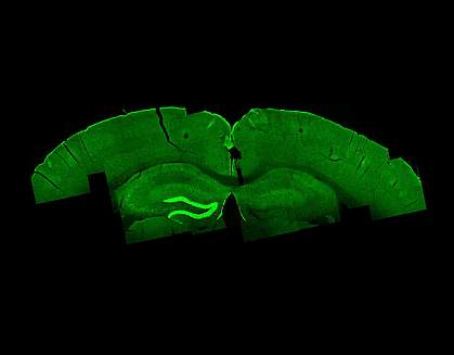 Temporal interference stimulation in mouse brain Temporal interference stimulation in mouse brain