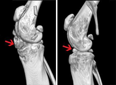 Mouse knees 3D reconstructions of mouse knees from phase-contrast micro-CT imaging