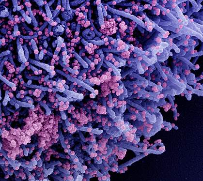 Novel Coronavirus SARS-CoV-2 Novel Coronavirus SARS-CoV-2