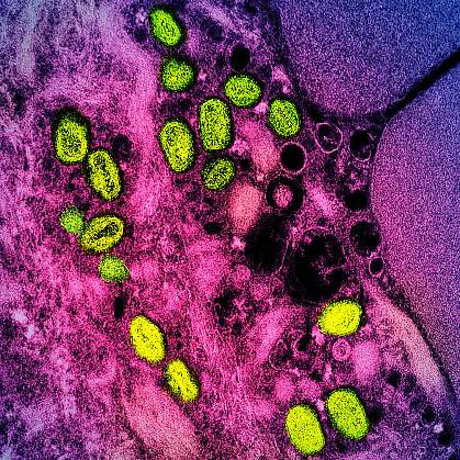 Green monkeypox particles in an infected cell visualized in pink and purple Green monkeypox particles in an infected cell visualized in pink and purple